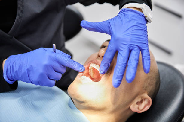 Best Emergency Dentist for Lost Fillings or Crowns in Hillandale, MD